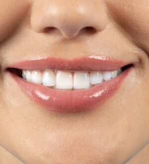 Найкращі стоматологічні кабінети в Полтаві