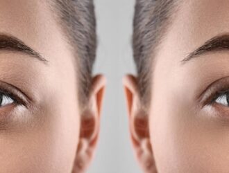 Блефаропластика: як позбутися “втомленого погляду” та зморшок навколо очей