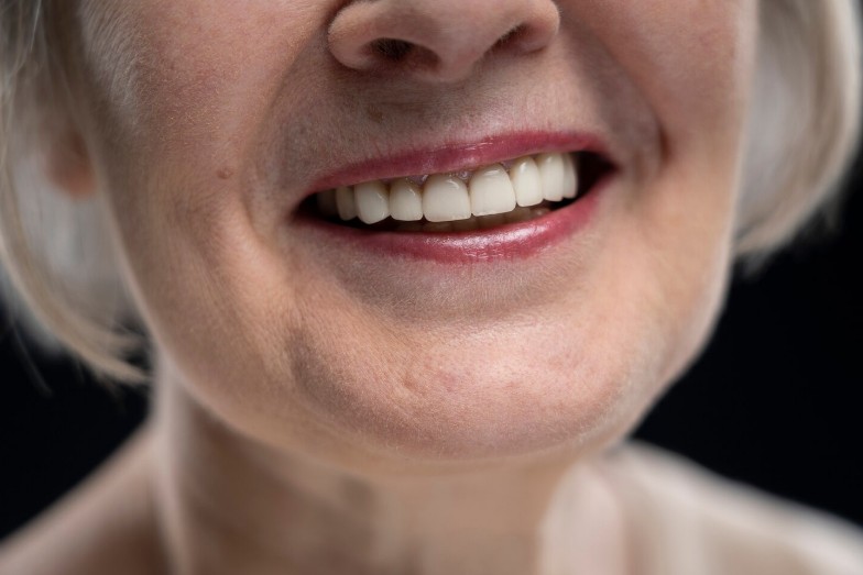 протезирование зубов