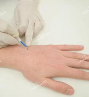 Бородавки у дорослих і дітей: причини, ризики та ефективне лікування