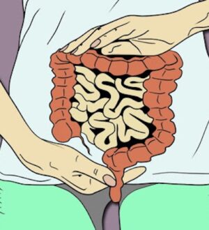 Хвороба Крона: симптоми, діагностика та сучасні методи лікування